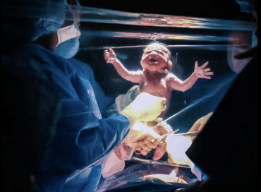 Wauw! Zulke mooie foto's van een bevalling via keizersnede heb je nog nooit gezien