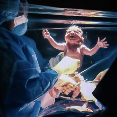 Illustratie bij: Wauw! Zulke prachtige foto’s van een bevalling via keizersnede heb je nog nooit gezien