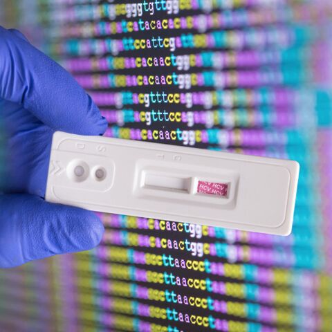 Illustratie bij: Allemaal een perfecte baby: huisartsen bieden DNA-test vóór de zwangerschap