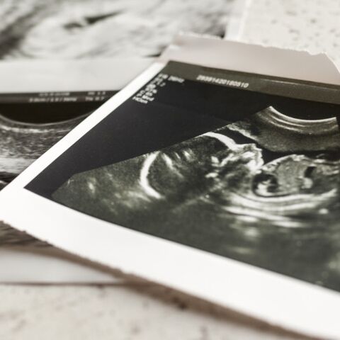 Illustratie bij: Emma onderging een late abortus: “Ik weet nog steeds niet of ik het juiste gedaan heb.”