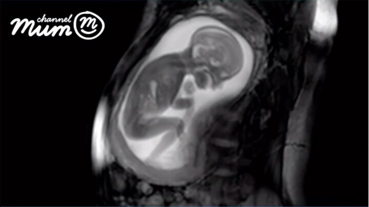 Deze MRI scan van een ongeboren baby is nog toffer dan een echo