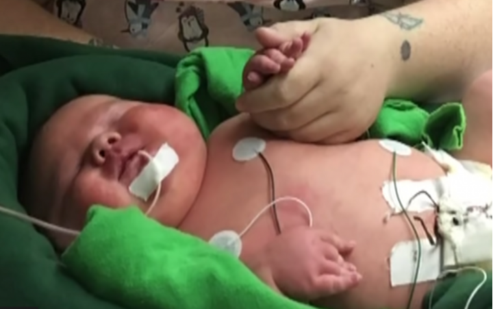 Deze enorme baby heeft een record gebroken in een Texaans ziekenhuis