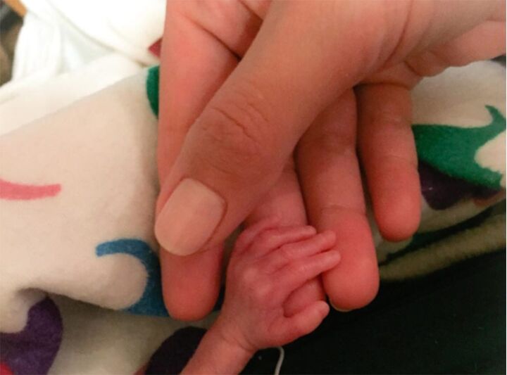 Deze ouders delen foto's van premature tweeling om mooie reden