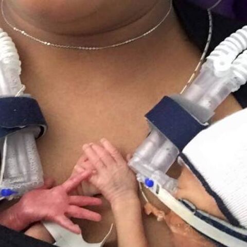Illustratie bij: Hartverwarmend en tranentrekkend: deze élf(!) weken te vroeg geboren baby’s laten elkaar niet meer los..