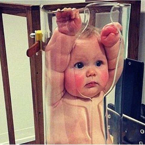 Illustratie bij: Huh? Wat is dit?! Geplette baby zorgt voor verwarring!