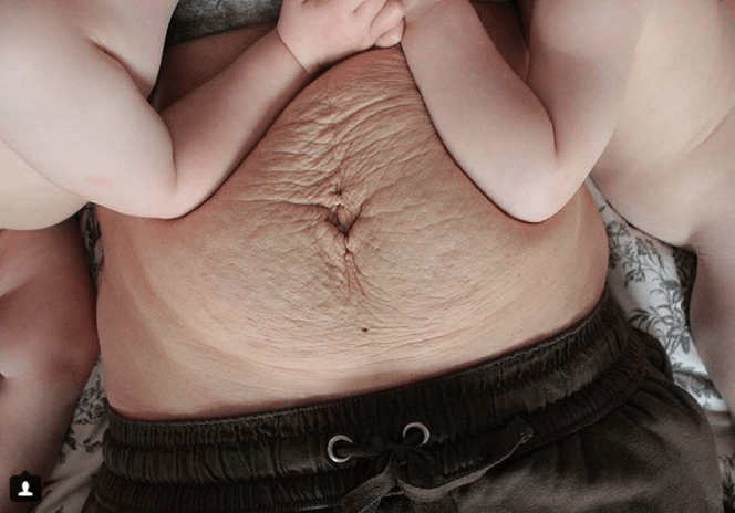 Instagramaccount takebackpostpartum deelt échte post-bevallingslijven (en dus geen onmogelijk strakke buiken)